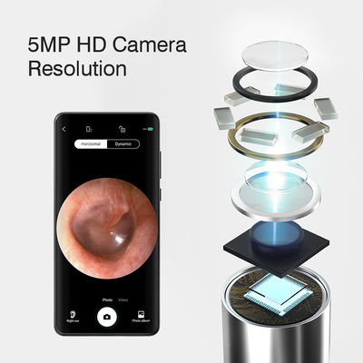 3.9mm HD Digital WiFi Ear Otoscope พร้อมฟังก์ชันทิศทาง AI และการเชื่อมต่อ WiFi